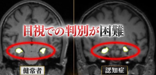 mri-gazou